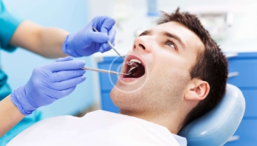 Trồng Răng Implant