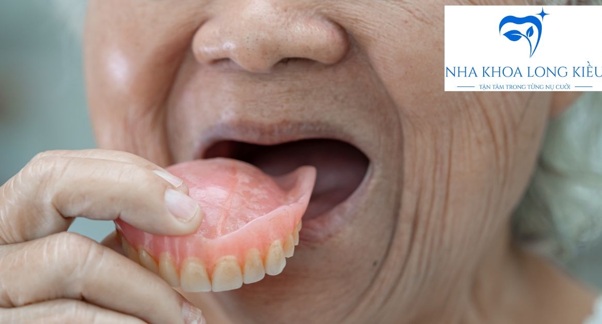 Chi Phí Làm Răng Hàm Giả Tháo Lắp: Bảng Giá Và Yếu Tố Ảnh Hưởng Đến Quyết Định