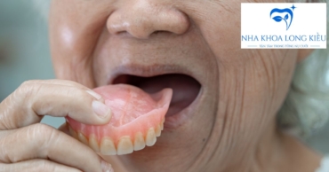 Chi Phí Làm Răng Hàm Giả Tháo Lắp: Bảng Giá Và Yếu Tố Ảnh Hưởng Đến Quyết Định