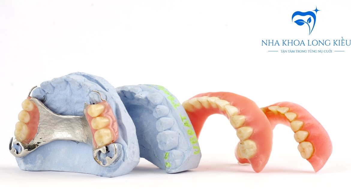 Trồng Răng Hàm Giả Tháo Lắp: Tổng Quan Về Các Loại Phục Hình Tháo Lắp