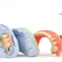 Trồng Răng Hàm Giả Tháo Lắp: Tổng Quan Về Các Loại Phục Hình Tháo Lắp
